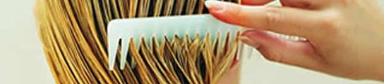 Alopecia femenina