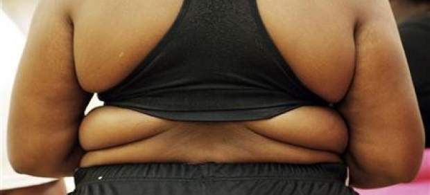 Obesidad Obesidad
