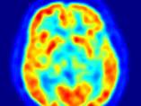 Cerebro Cerebro