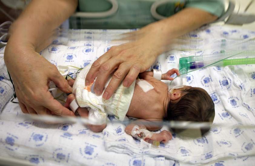 Bebés prematuros: ¿qué causas provocan que cada vez se den más ...