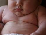 Obesidad infantil Obesidad infantil