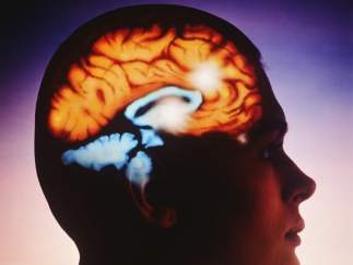 Cerebro