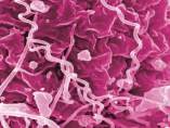 Treponema pallidum, bacteria de la sífilis