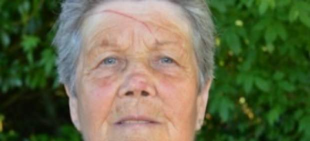 La mujer atacada por el águila, con las heridas