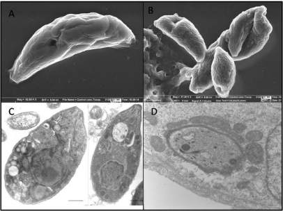 Imágenes parásitos de Toxoplasma