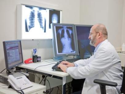 Cáncer de pulmón