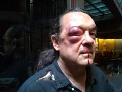 Agreden a Fernando Barredo por intervenir en un caso de violencia machista