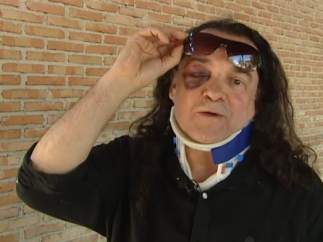 Fernando Barredo