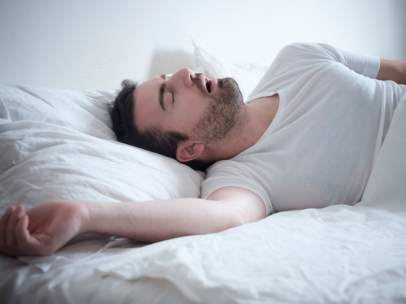 Apnea del sueño
