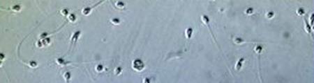 Espermatozoides, en una muestra de semen Espermatozoides, en una muestra de semen