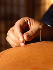 Sin dolor Sin dolor