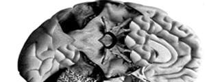 Cerebro Cerebro