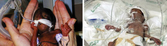 Los bebés más pequeños son también más propensos a la depresión Los bebés más pequeños son también más propensos a la depresión