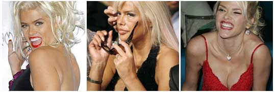 Anna Nicole Smith Anna Nicole Smith