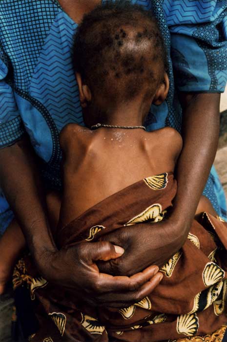 Los más pequeños, los peor parados en África Los más pequeños, los peor parados en África