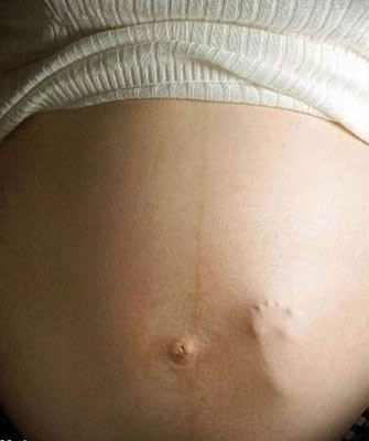 Mujer embarazada Mujer embarazada