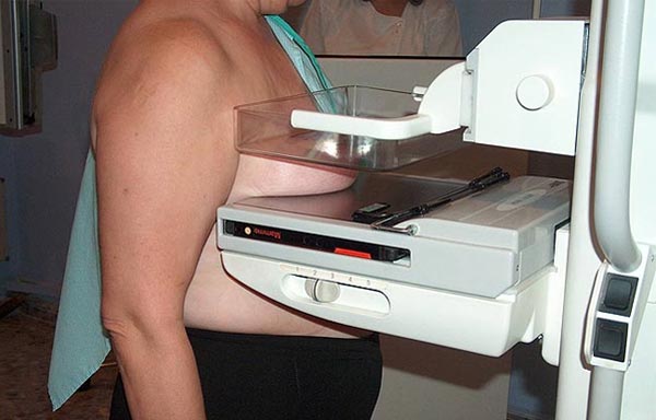 Una mamografía Una mamografía