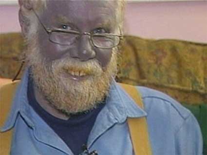 Paul Karason, el hombre que parece Papá Pitufo Paul Karason, el hombre que parece Papá Pitufo