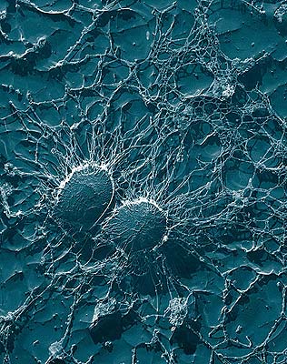 Staphylococcus aureus Staphylococcus aureus