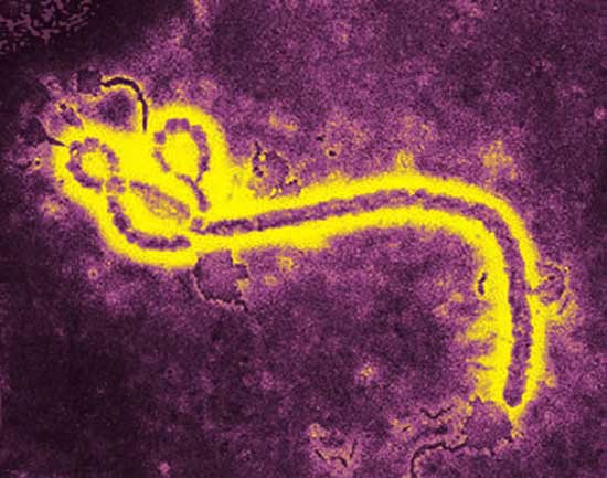 Imagen del virus ébola Imagen del virus ébola