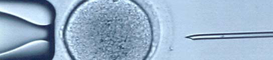 Fecundación in vitro Fecundación in vitro
