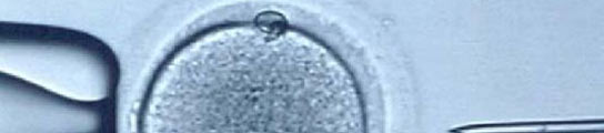 Inseminación in vitro Inseminación in vitro