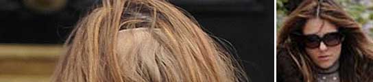 Calva de Liz Hurley.