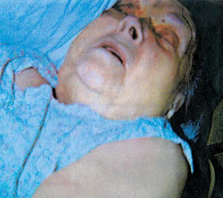 Denuncias de maltrato en una residencia Denuncias de maltrato en una residencia