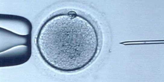 Fecundación in vitro Fecundación in vitro
