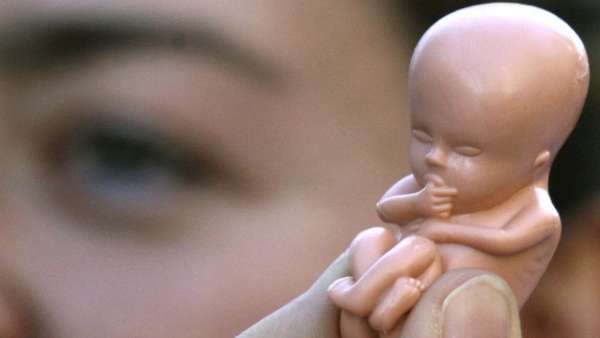 Aborto Aborto