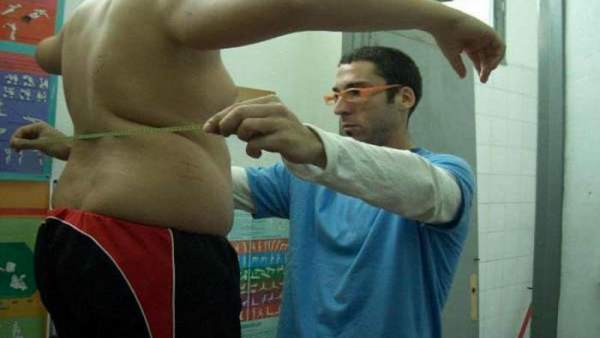 Obesidad Obesidad