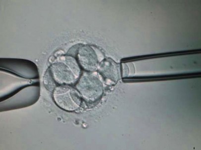 Biopsia