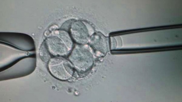 Biopsia Biopsia