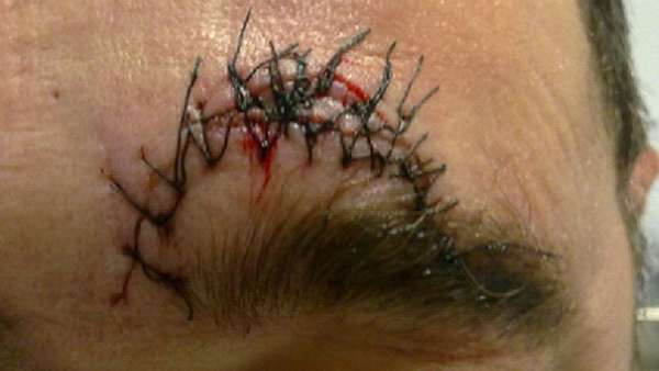 Agredido en su bar Agredido en su bar