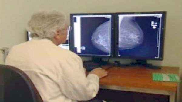 Cáncer Cáncer