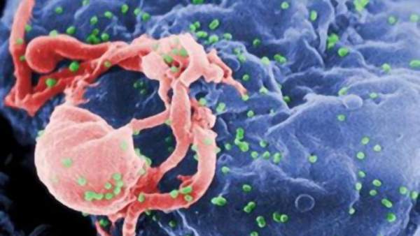 Virus del VIH Virus del VIH