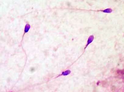 Espermatozoides