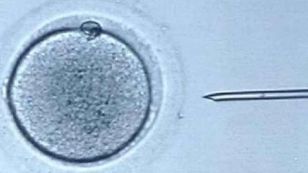 Fecundación in vitro Fecundación in vitro