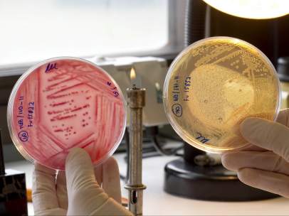 E. Coli