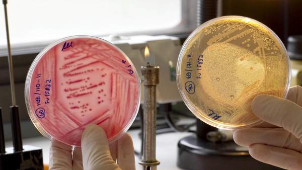 E. Coli E. Coli