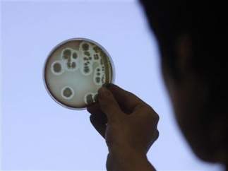 Semillas causantes de la 'E.coli'