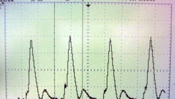 Electrocardiograma Electrocardiograma