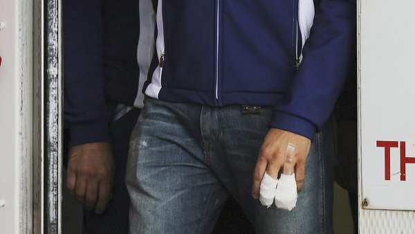Imagen de la mano dañada de Lorenzo Imagen de la mano dañada de Lorenzo
