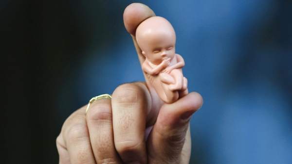 Aborto Aborto