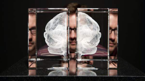 Cerebro Cerebro