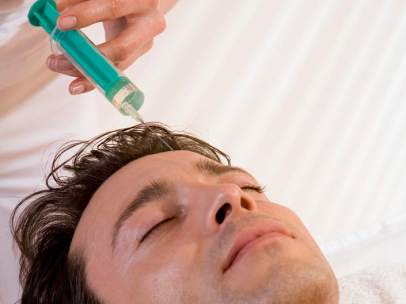Botox para el hombre