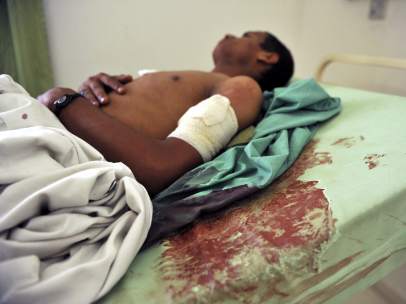 Yemen