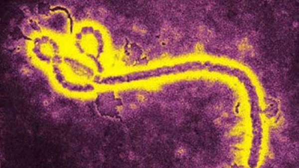 Virus del Ébola Virus del Ébola