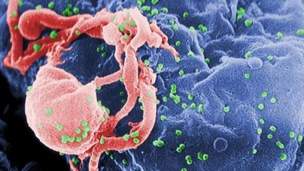 Virus del sida, VIH Virus del sida, VIH