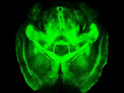 Cerebro transparente